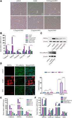 Network pharmacology and experimental analysis to reveal the mechanism of Dan-Shen-Yin against endothelial to mesenchymal transition in atherosclerosis